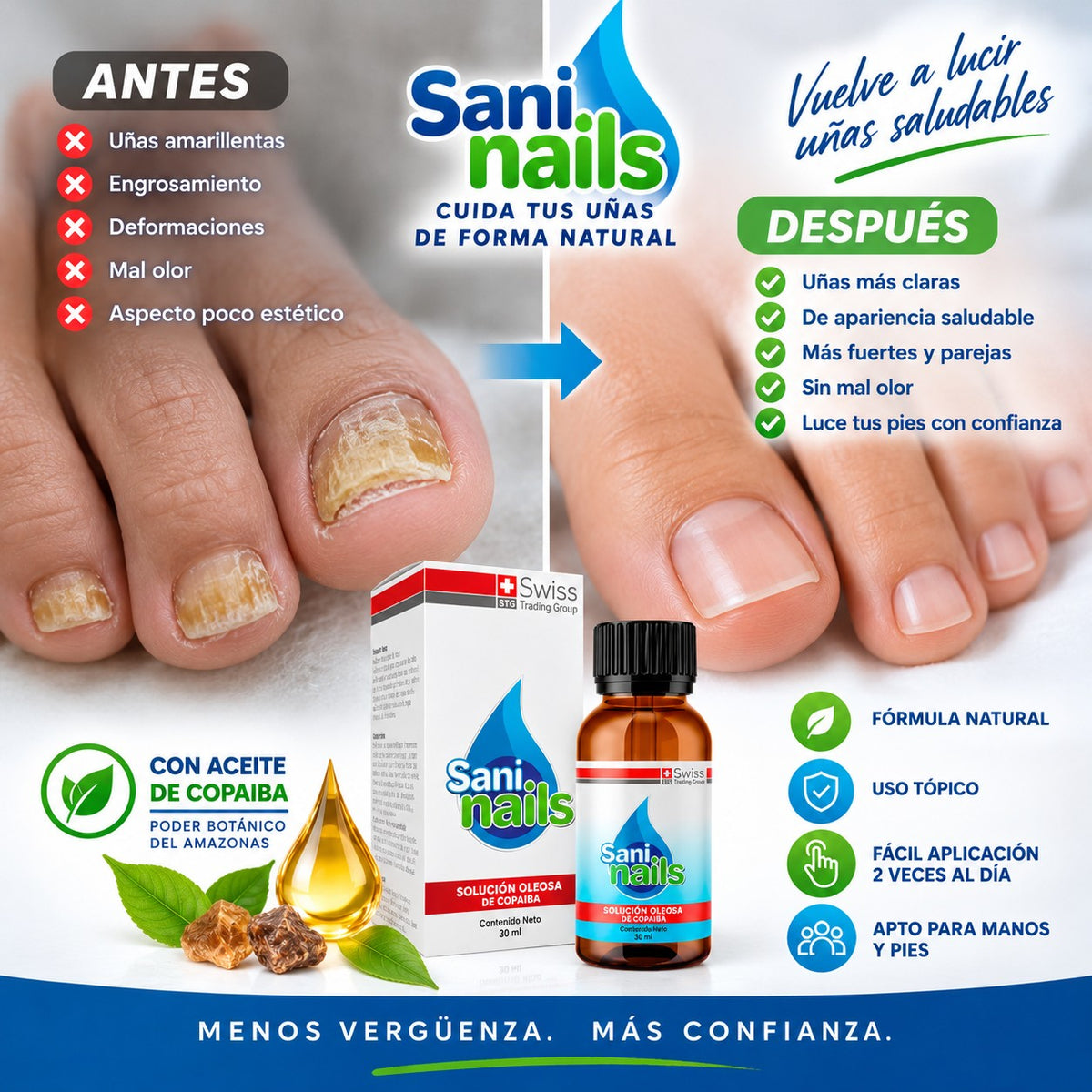 SaniNails Ayuda a Combatir Hongos Uñas
