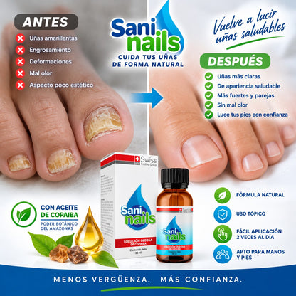 SaniNails Ayuda a Combatir Hongos Uñas